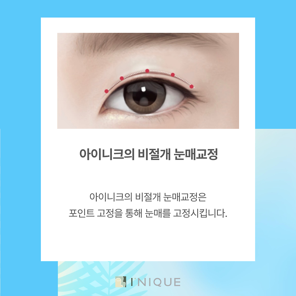 Eyelid Correction Near Gangnam Station at Inique image 3