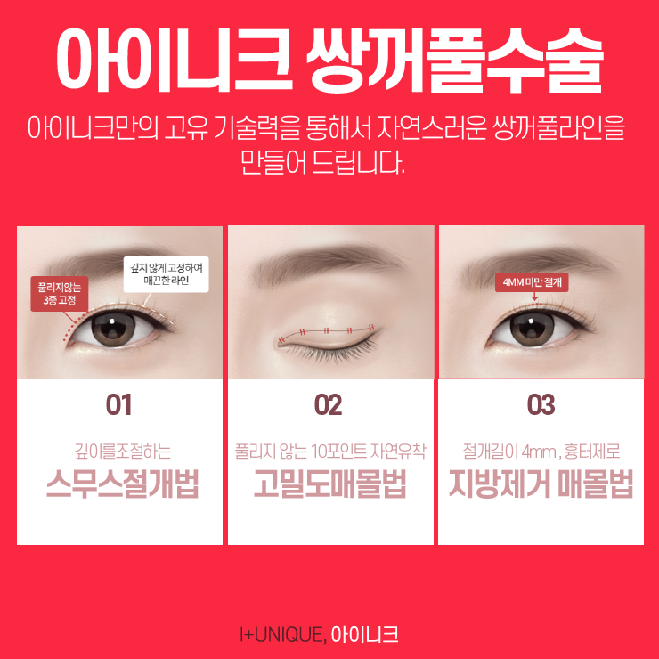 서울눈성형외과를 알아본다면, 신중한 결정이 필요하다 관련 이미지 2