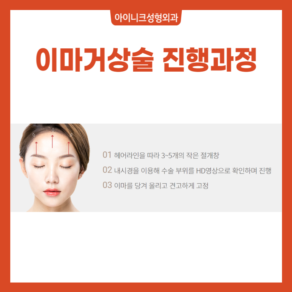 이마주름수술, 탄력있게 변화해보세요! 관련 이미지 4