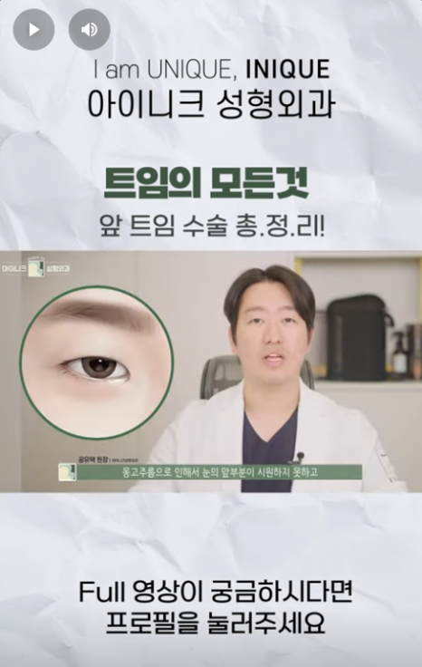 A Complete Guide to Apgujeong Epicanthoplasty!! image 6