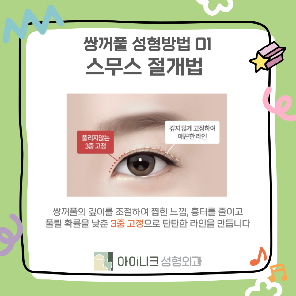 쌍꺼풀수술병원에서 알려드리는 종류와 선택 관련 이미지 9