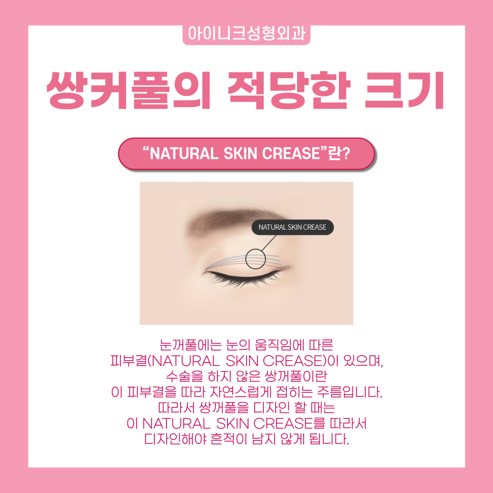 연예인눈성형을 원한다면 눈 성형 전문의에게! 관련 이미지 4