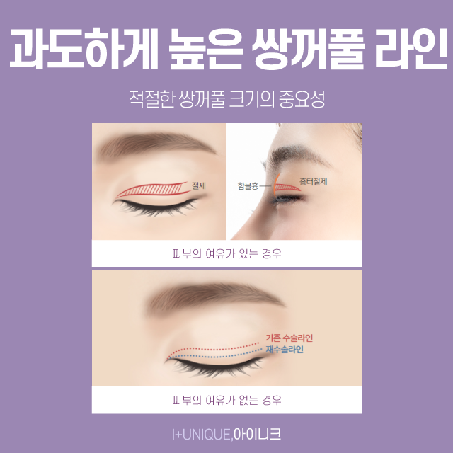 압구정재수술병원을 찾고 있다면 지금 여기!! 관련 이미지 3