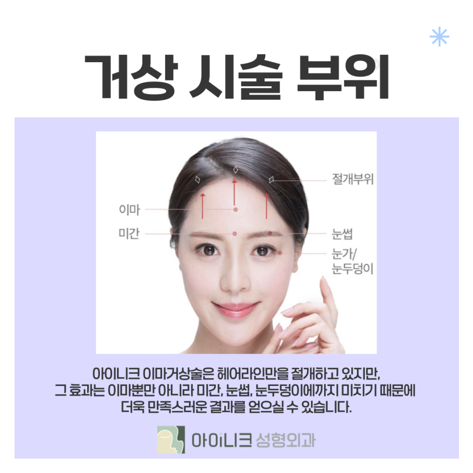 처진눈썹교정 방법 찾고 있을 때 관련 이미지 7