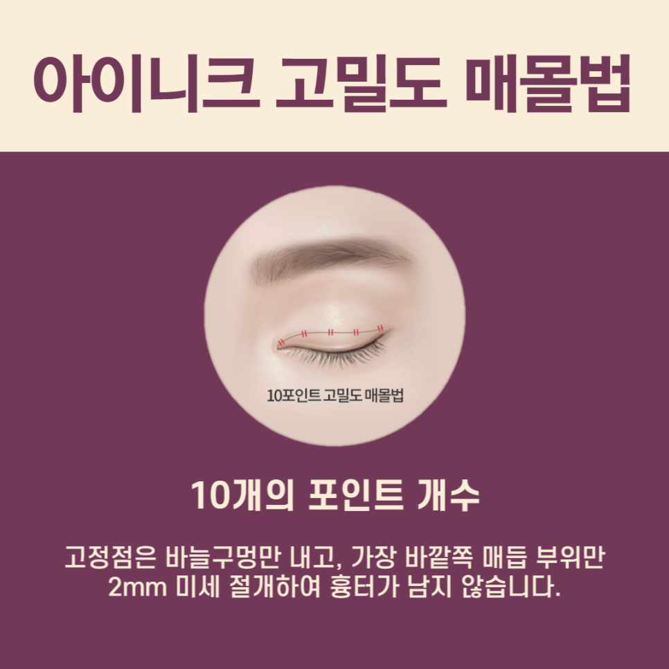 What Should You Check Before Choosing a Famous Plastic Surgery Clinic in Seoul? image 5