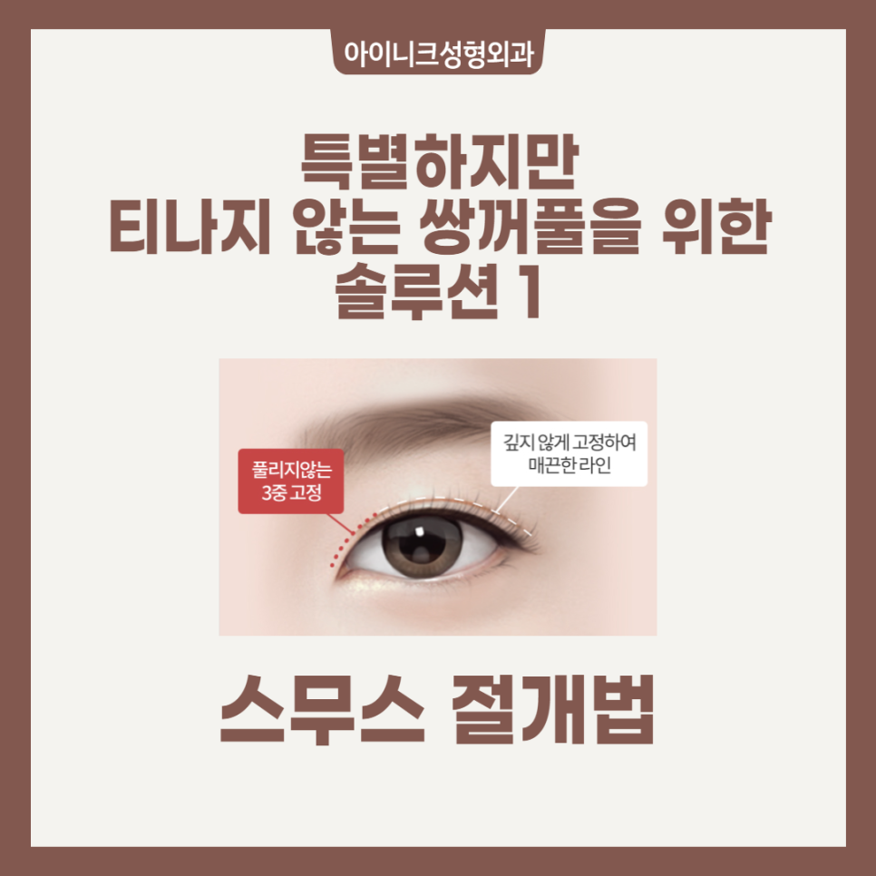 성형외과 발품 팔기? 강남쌍수병원 아이니크가 정답 관련 이미지 3
