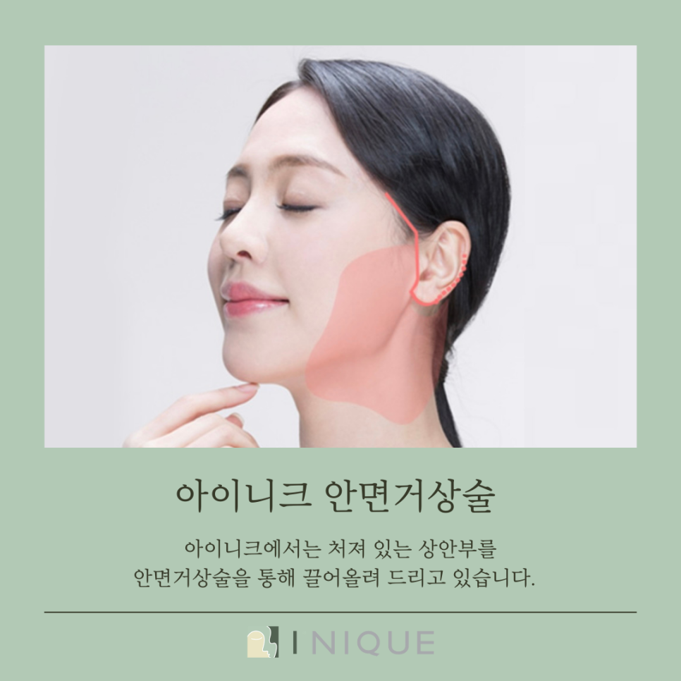주름살제거, 어떻게 할까요? 관련 이미지 5