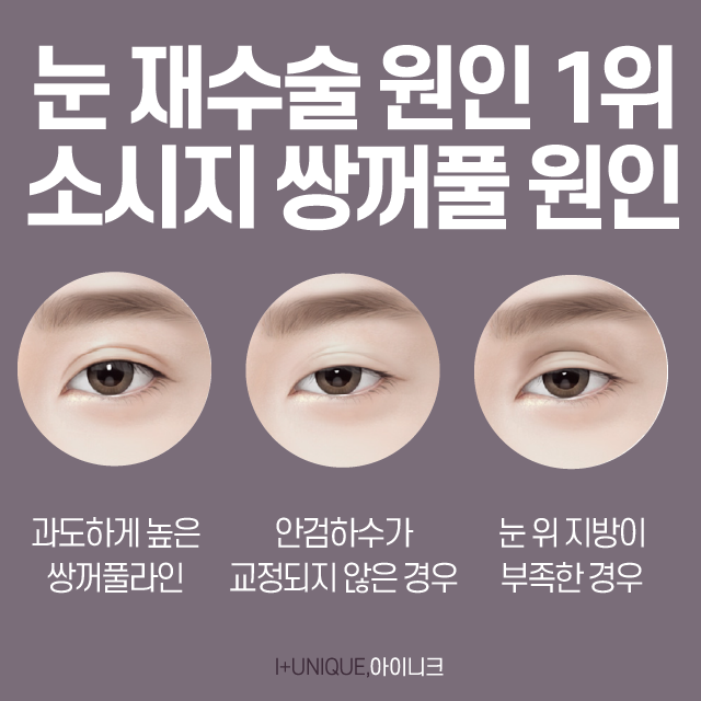 쌍수 붓기 빨리 빼는 법? 소시지 주사가 답! 관련 이미지 2