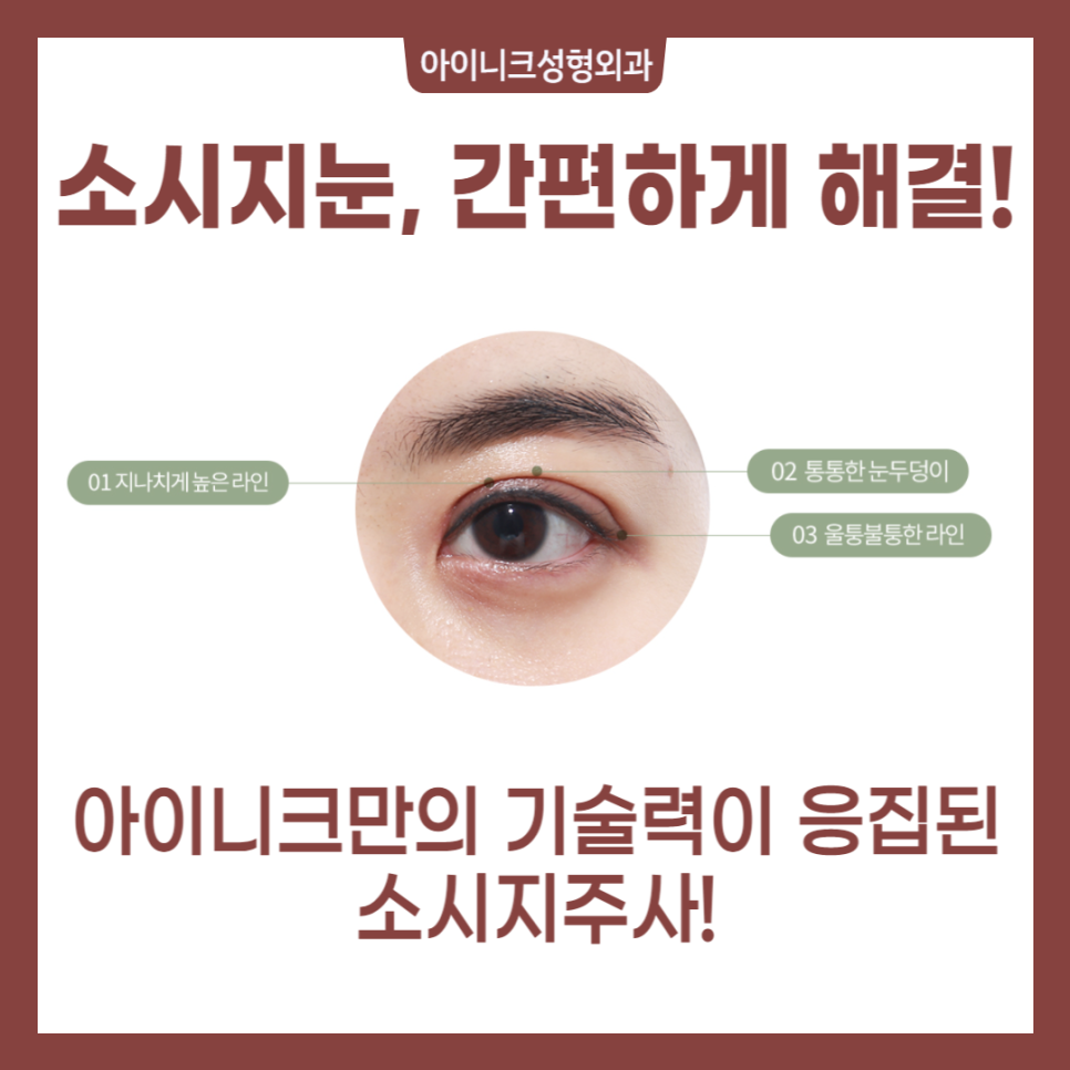 쌍꺼풀 붓기제거 효과적인 방법을 찾는다면 관련 이미지 2