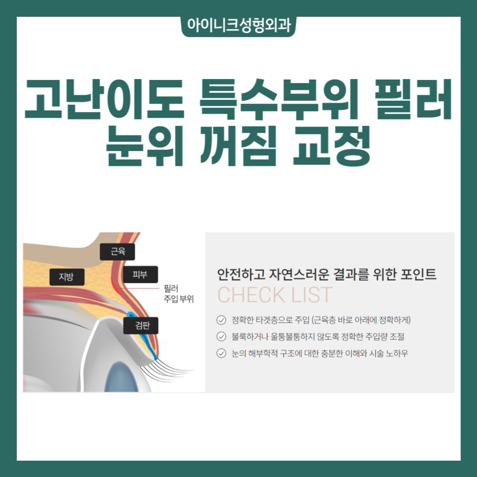 다양한 쁘띠성형종류, 제대로 알아보자! 관련 이미지 4