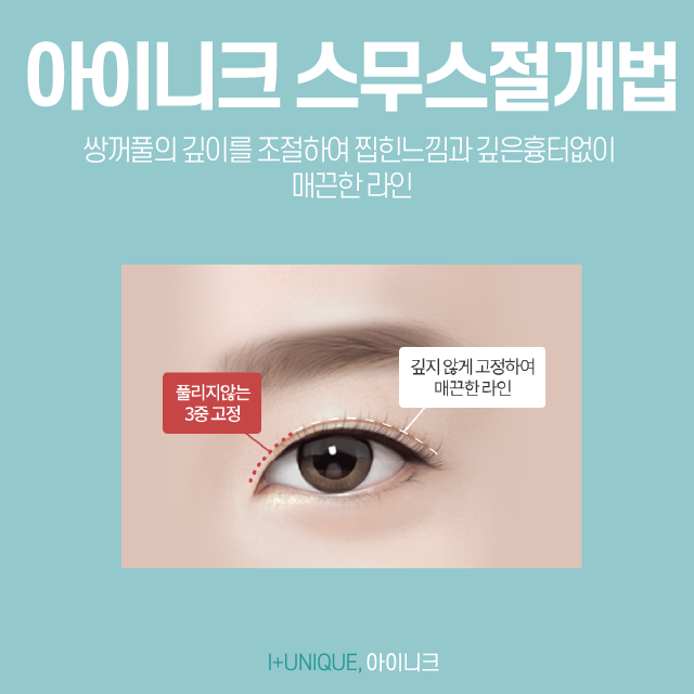 서울쌍커풀수술을 알아보고 있다면 아이니크 성형외과로 관련 이미지 3