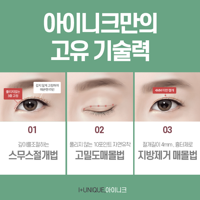 쌍꺼풀수술, 나만을 위한 디자인을 원한다면? 관련 이미지 4