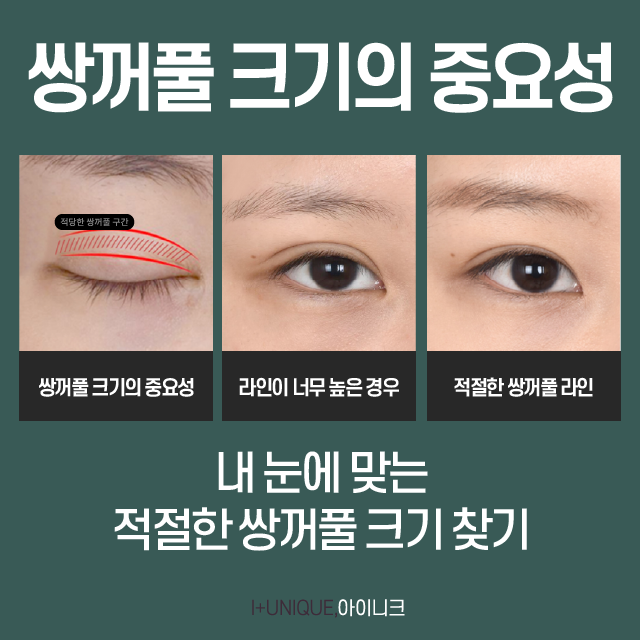 A Great Place for Double Eyelid Surgery: Want to Know the Secret? image 4