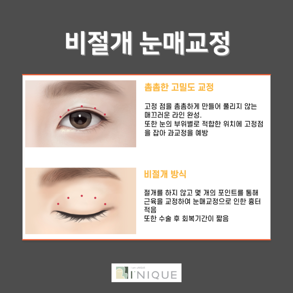 눈처짐해결에 가장 효과적인 방법! 관련 이미지 5