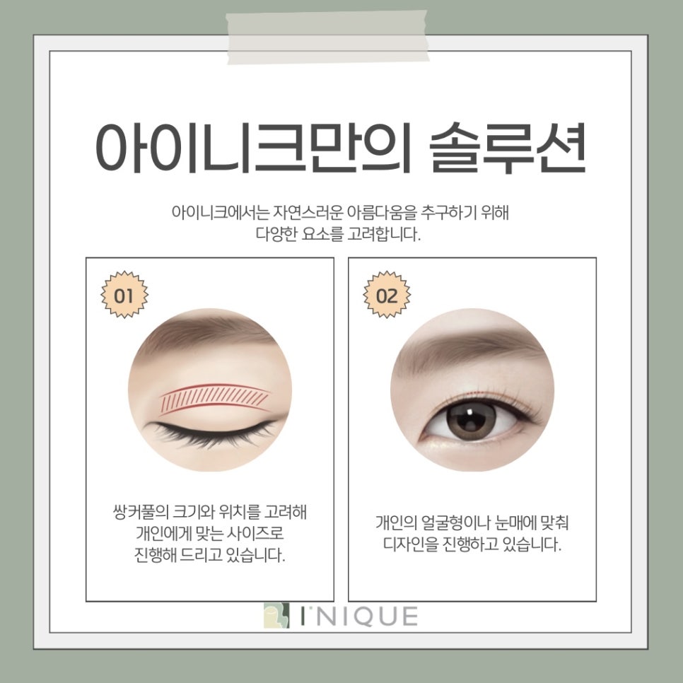 남자쌍수잘하는곳 찾을 때 관련 이미지 5