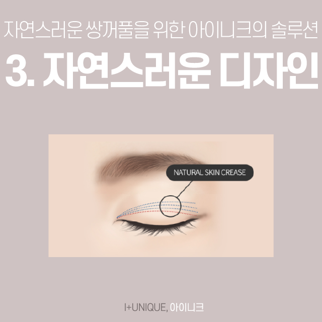 티나는쌍꺼풀은 NO! 자연스러운 쌍꺼풀라인을 만드는 아이니크로 오세요! 관련 이미지 5