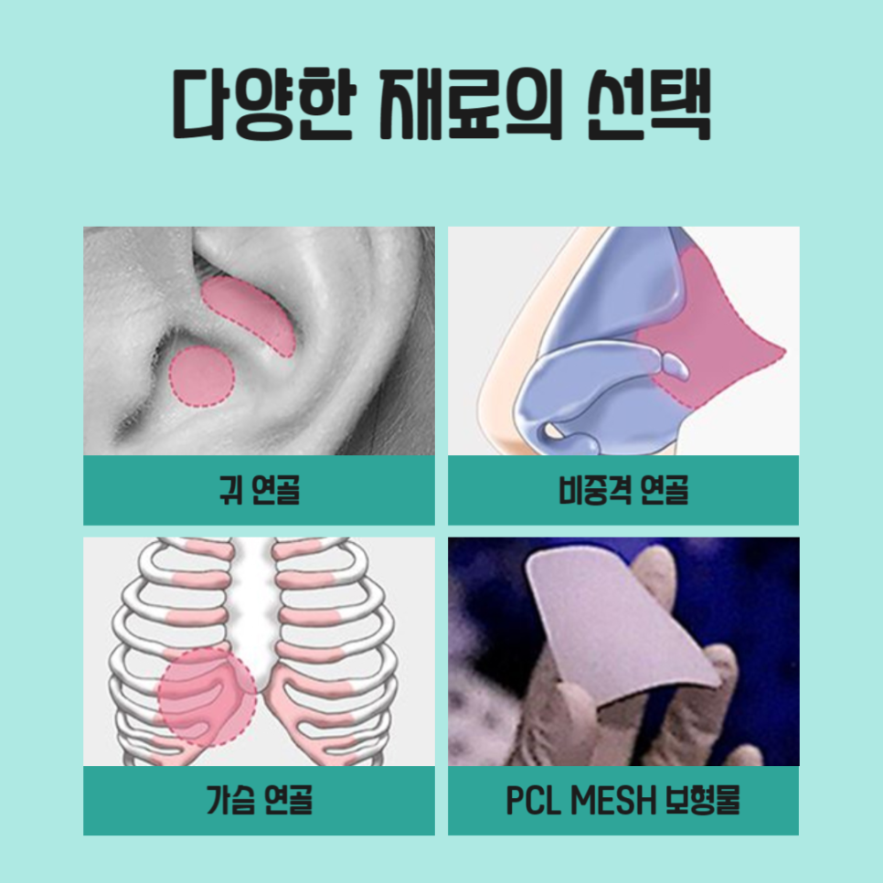 코성형붓기 걱정없는 아이니크의 코성형 관련 이미지 4