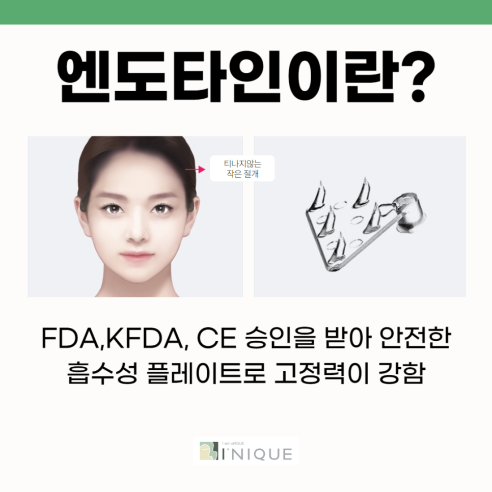 What Is an Endotine Forehead Lift? image 4