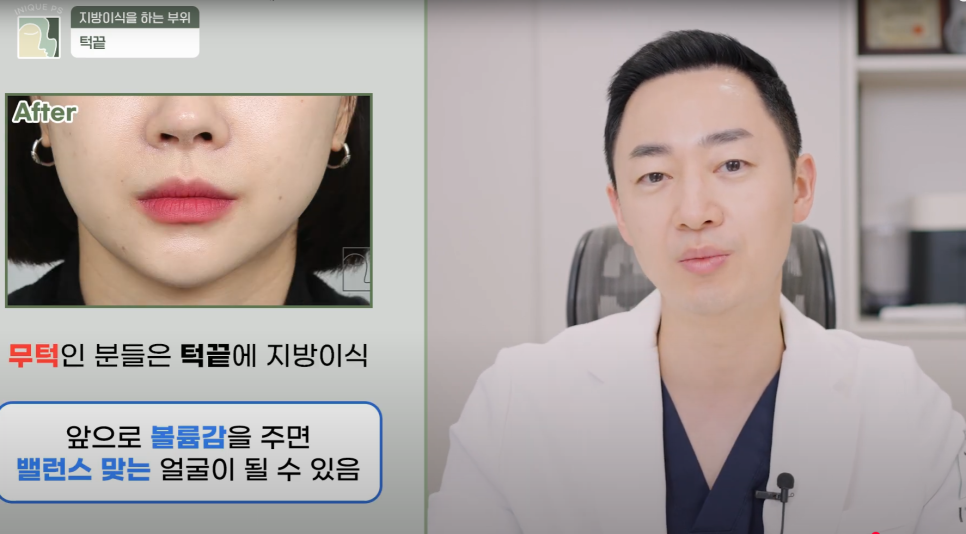 Look Younger with Gangnam Encore Under-Eye Fat Grafting! image 12