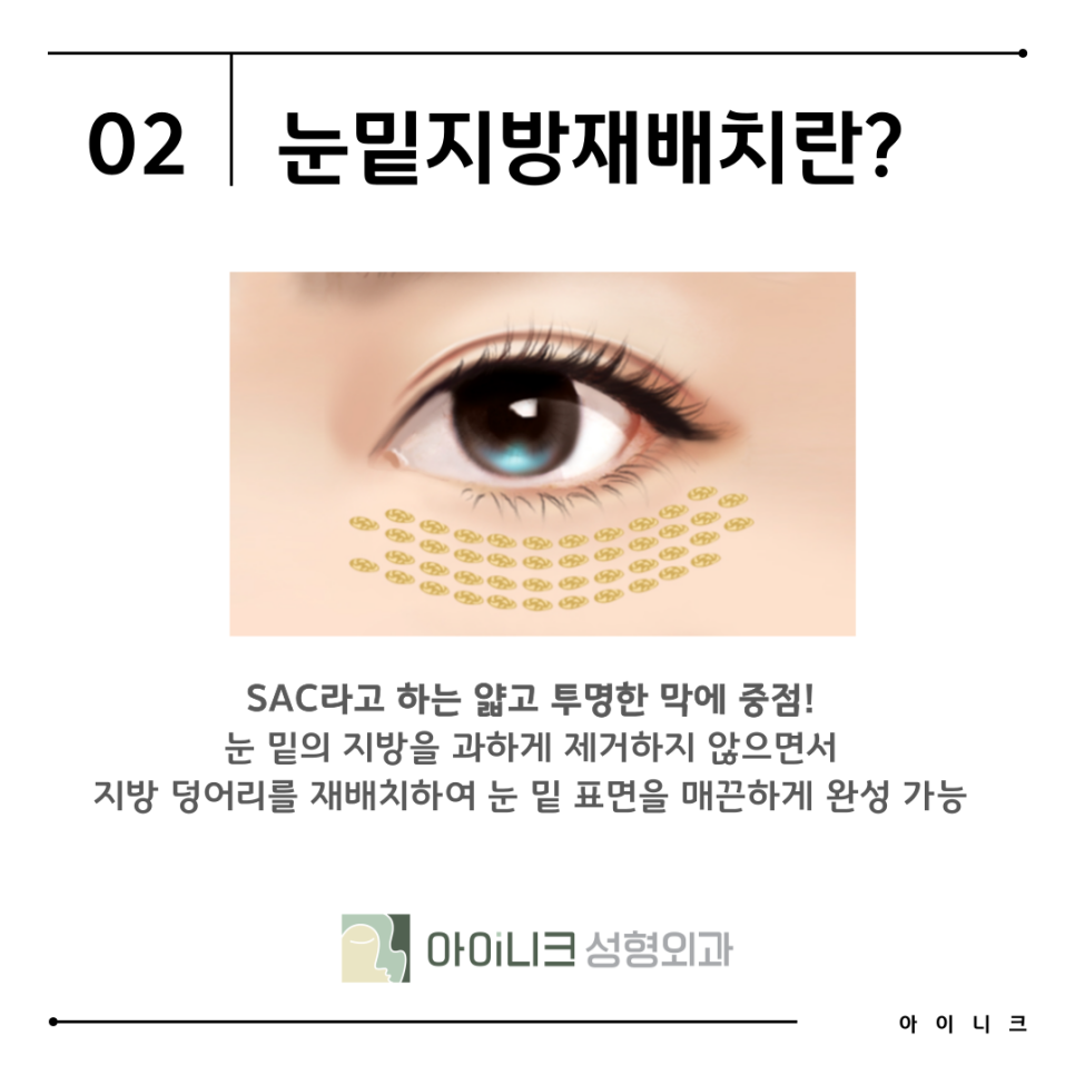 Recommended Hospital for Under-Eye Fat Repositioning: Finding the Right Method for Me image 7