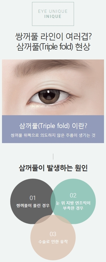 풀린쌍꺼풀 여러 겹의 쌍꺼풀 개선하는 방법! 관련 이미지 2
