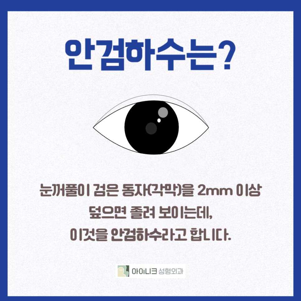 안검하수잘하는곳 찾고 있나요? 관련 이미지 2