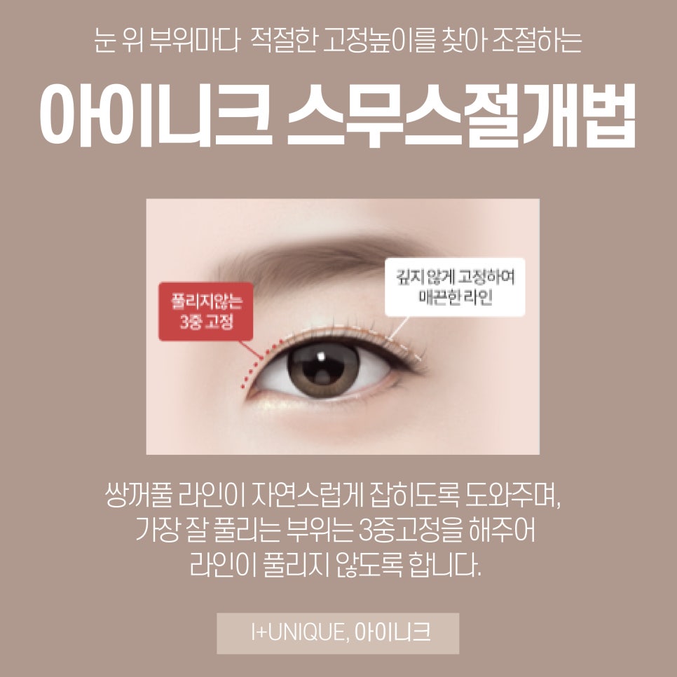 쌍꺼풀수술병원 믿을 수 있는 선택, 아이니크성형외과 관련 이미지 4