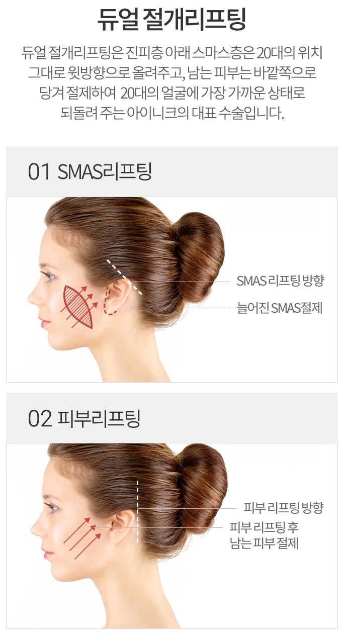안면거상술비용 만족할 수 있는 시술 관련 이미지 3