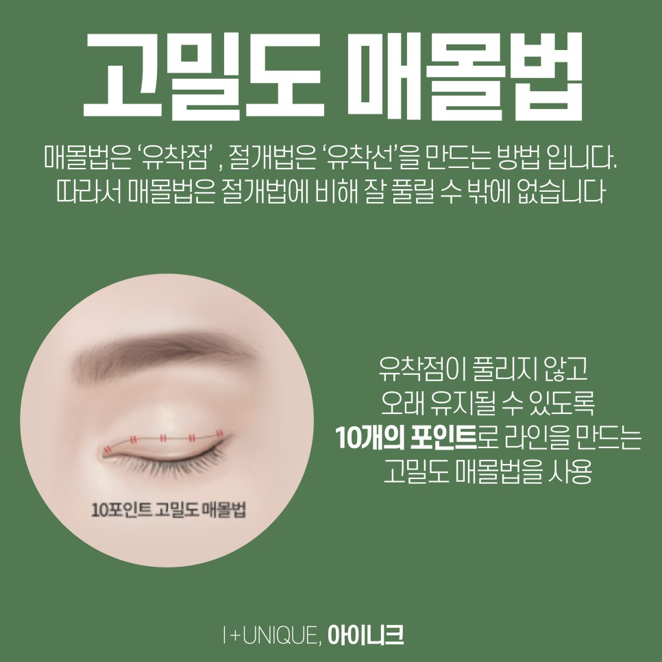 쌍수잘하는병원 아이니크성형외과에서 만드는 또렷한 눈매 관련 이미지 5