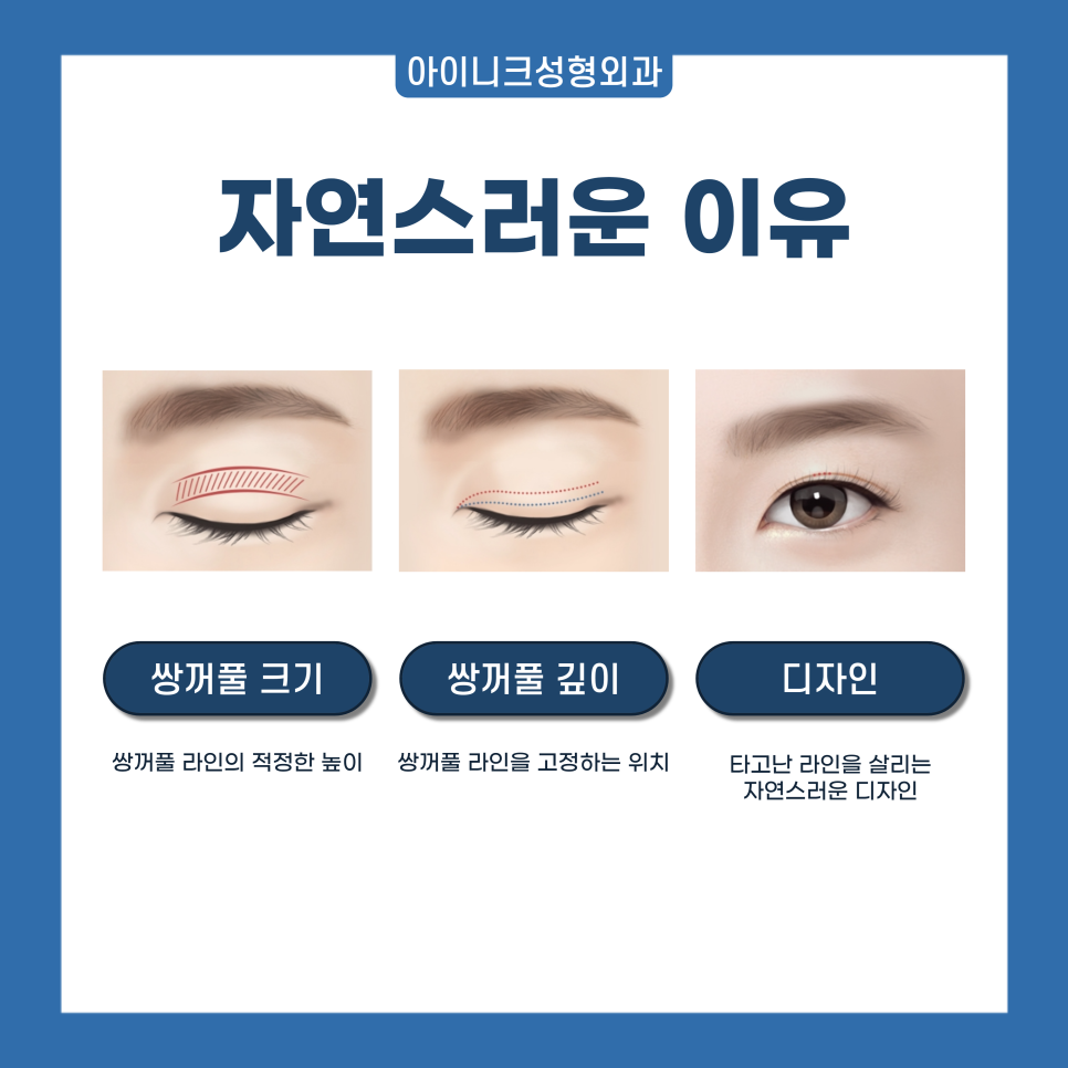 Where to Get Natural and Skillful Eyelid Surgery in Gangnam image 2