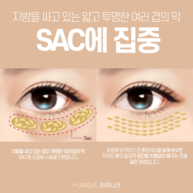 Don’t Worry About Dark Circles Anymore! Learn About the Price of Dark Circle Surgery image 3