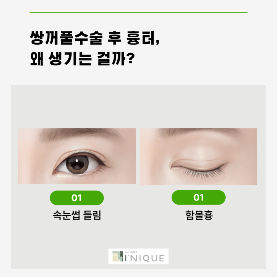 쌍수재수술병원 마지막수술이 되도록 관련 이미지 2