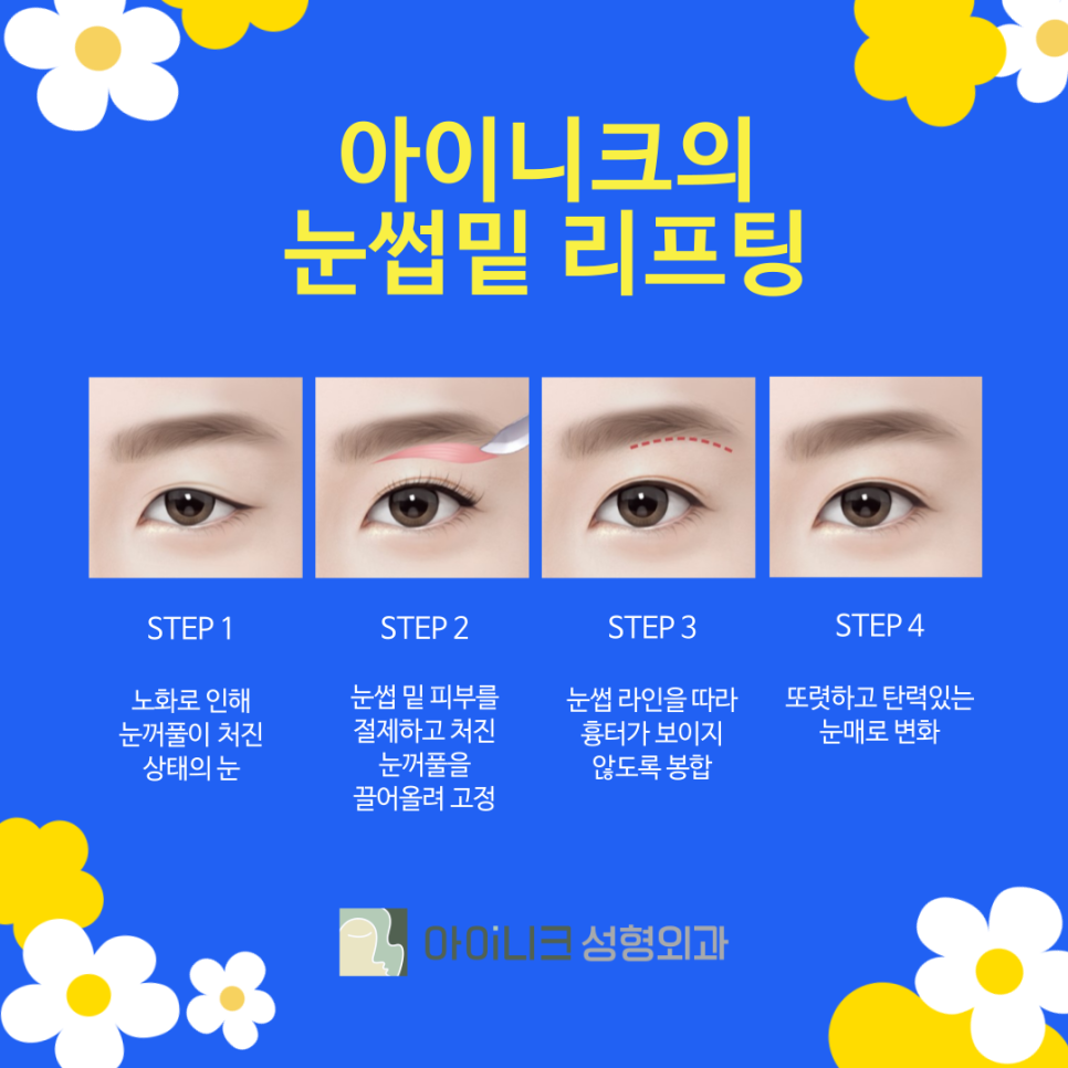 A filial cosmetic procedure to help your mother regain her youth image 4