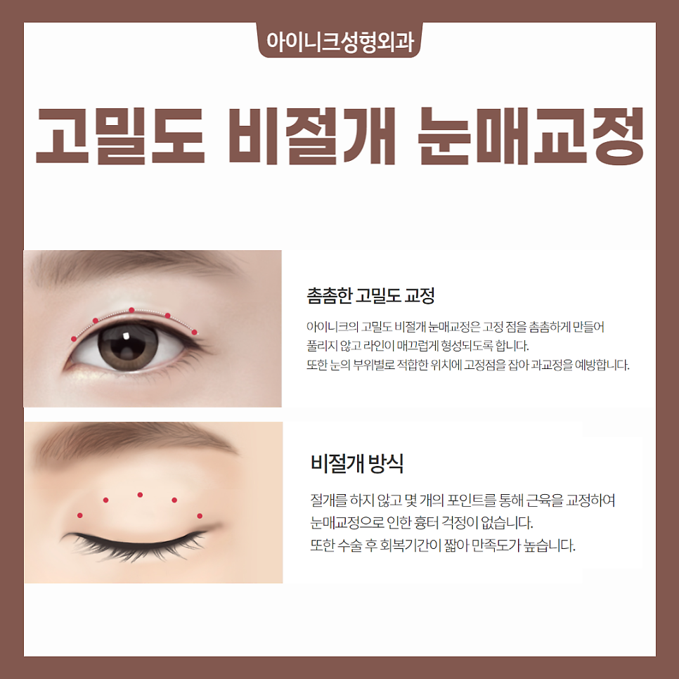 When Ptosis Correction Is Needed image 4