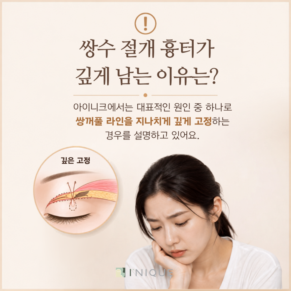 쌍수 절개 흉터, 깊게 남았다면 재수술을 해야 하나? 관련 이미지 2