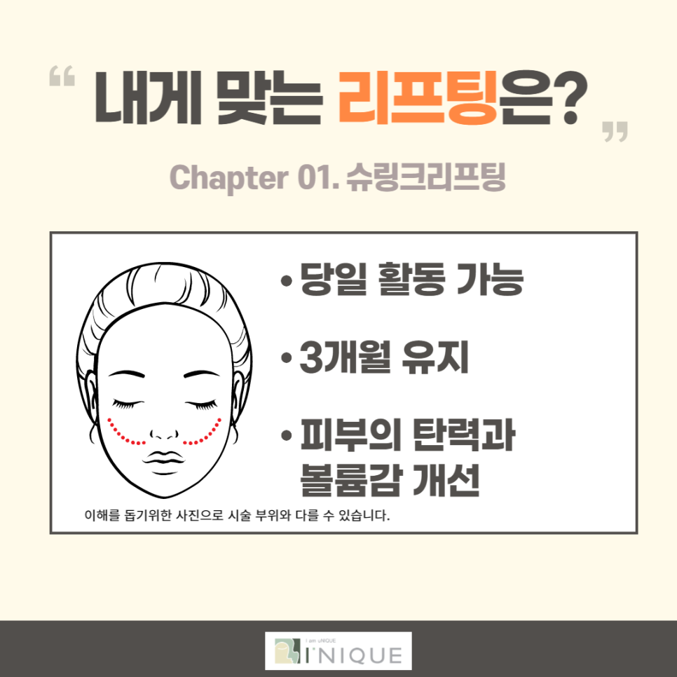 Forehead Lift Surgery in Your 20s: Effectively Improving Deep Wrinkles image 4