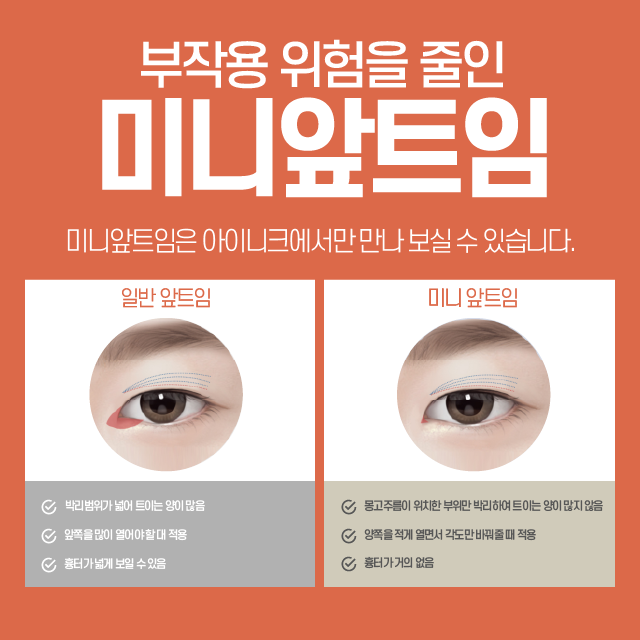 안전한 앞, 뒤트임복원 수술로 새롭게 태어나세요! 관련 이미지 3