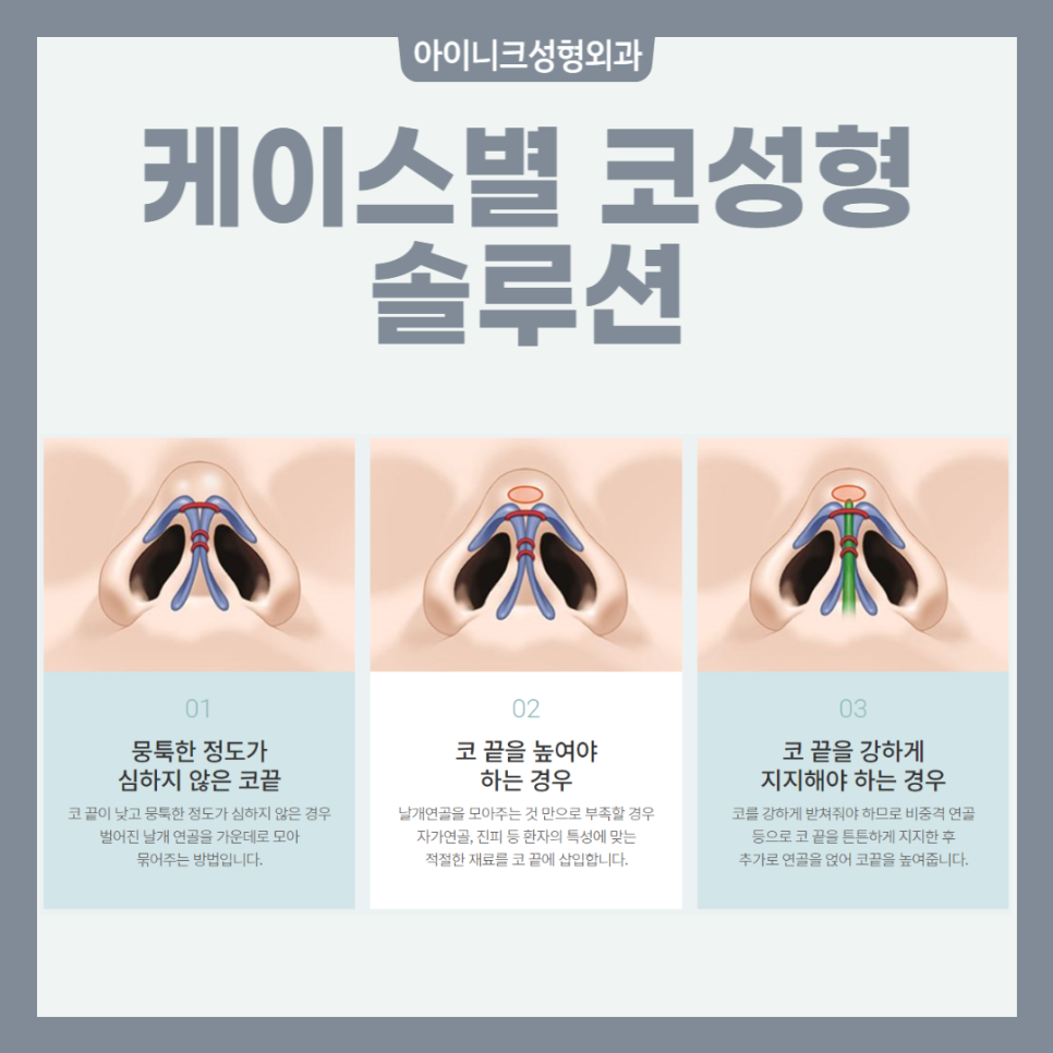 코끝시술 처짐 없는 매끈한 라인 관련 이미지 3