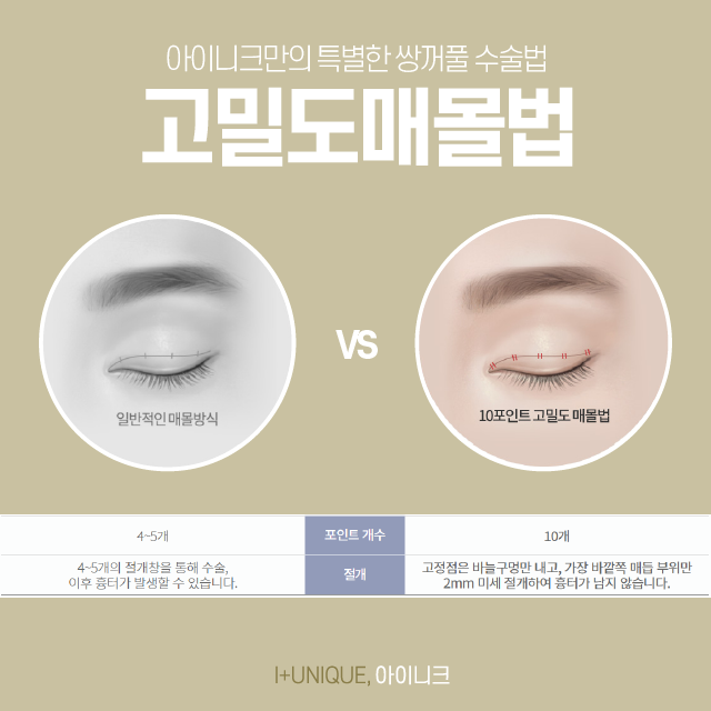 Types of Double Eyelid Surgery: Which Design Suits My Eyes? image 4