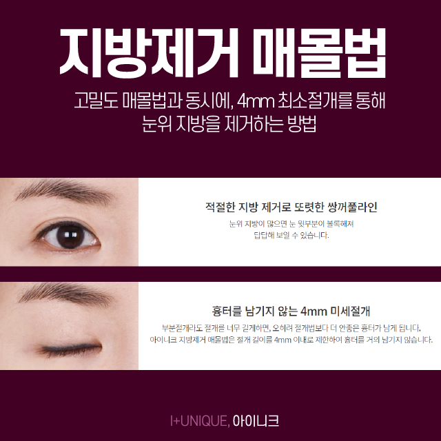 Looking for a plastic surgery clinic in Apgujeong for double eyelid surgery with no side effects? image 5