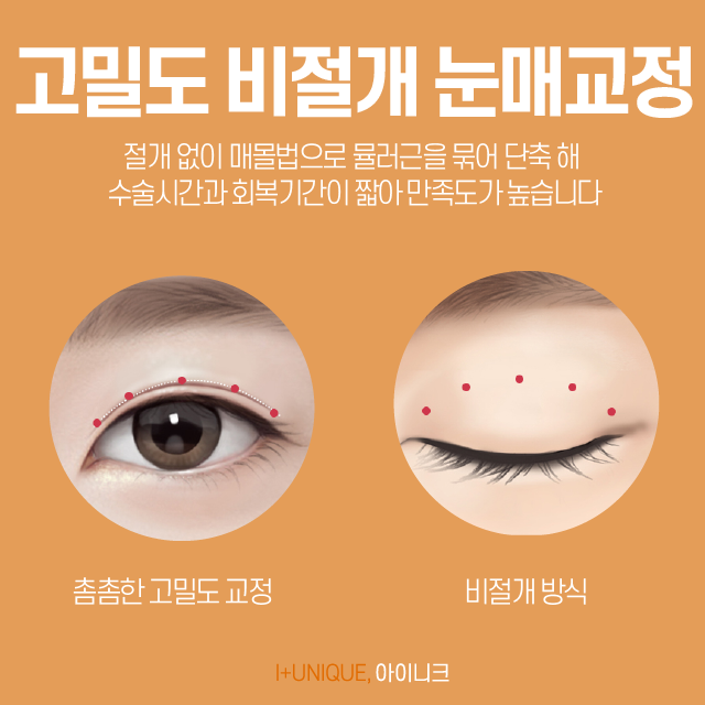 압구정눈매교정, 원인부터 결과까지 확실하게 알아야 합니다. 관련 이미지 4