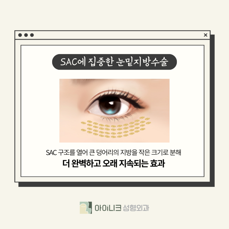 서울눈밑성형, 노하우가 중요 관련 이미지 4