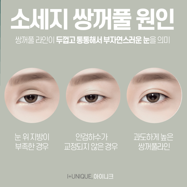 눈재수술병원을 알아보고 있다면, 신중해야 하는 이유 관련 이미지 2