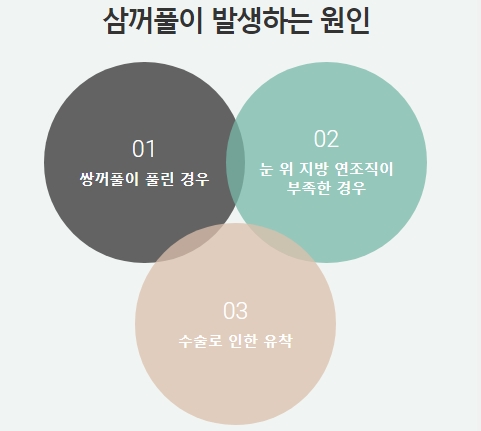 겹쌍꺼풀수술 원인별 맞춤 솔루션으로 완벽 해결! 관련 이미지 2