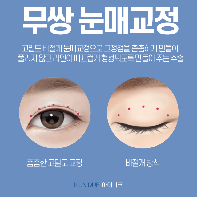 남자눈매교정수술로 남성의 눈에 맞는 디자인을! 관련 이미지 4