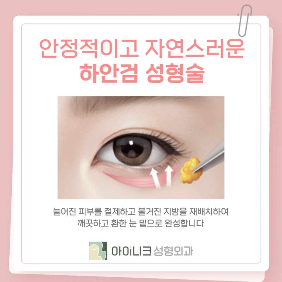 다크서클제거 손상적은 개선방법 관련 이미지 12