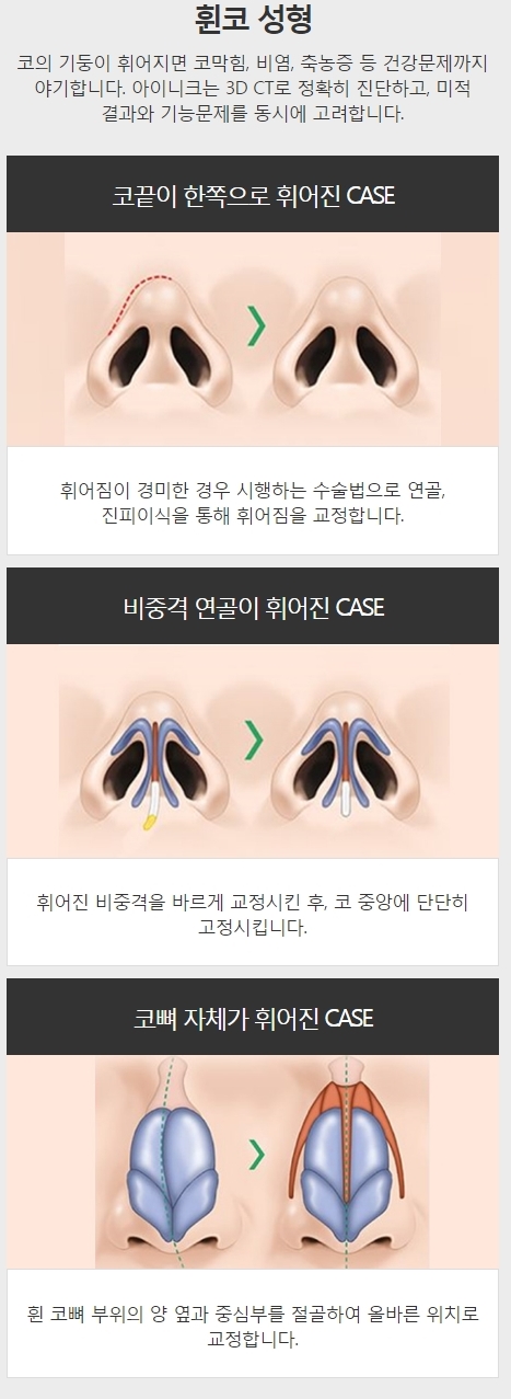 여자매부리코수술 특징에 맞는 유형별 코성형! 관련 이미지 6