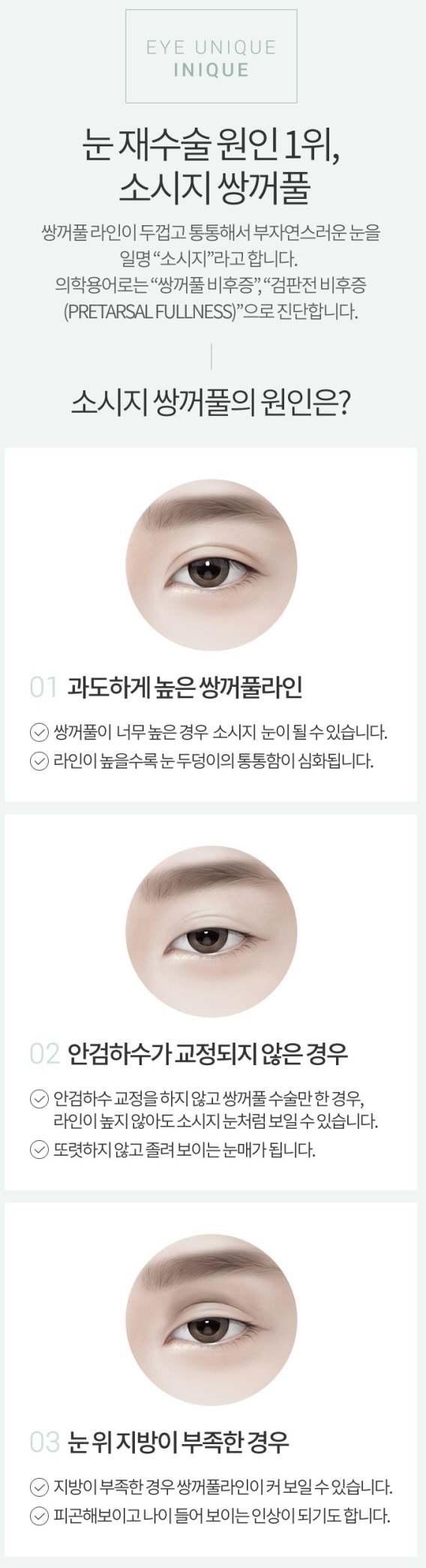 쌍커플재수술비용 원인별 맞춤 솔루션 제공! 관련 이미지 3