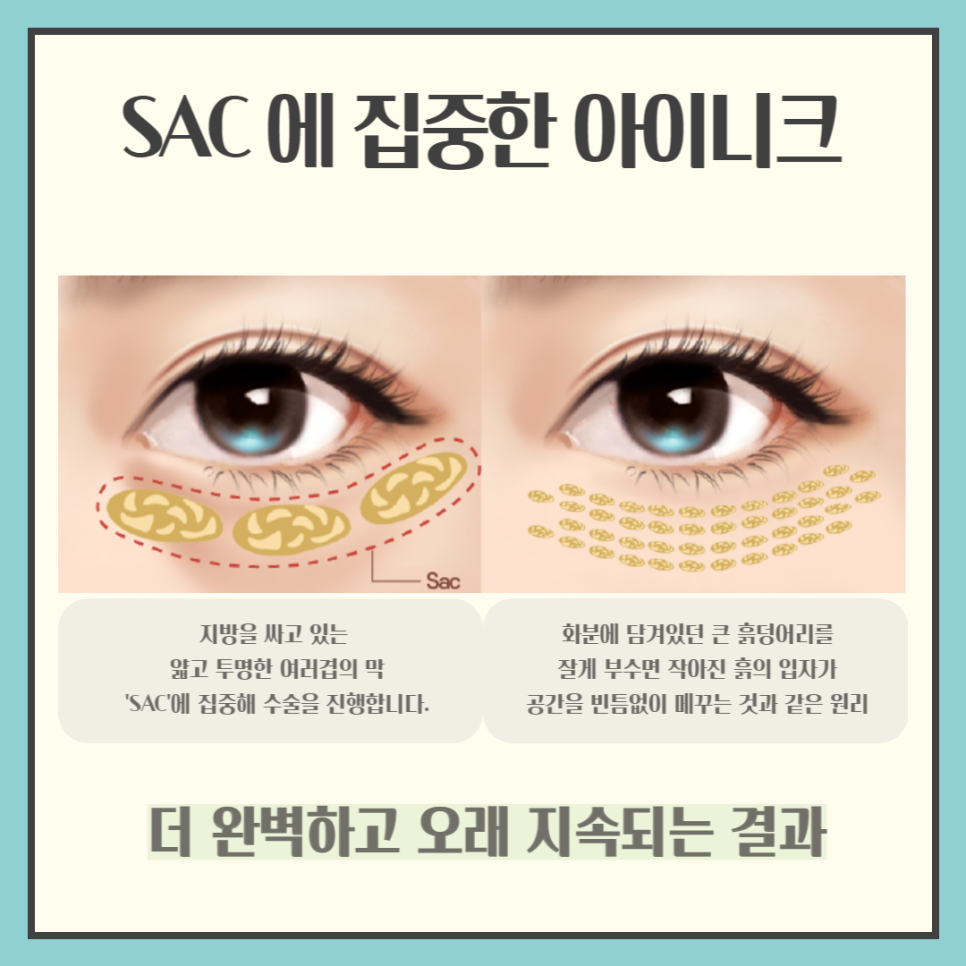 눈밑지방재배치통증이 걱정이라면 관련 이미지 2