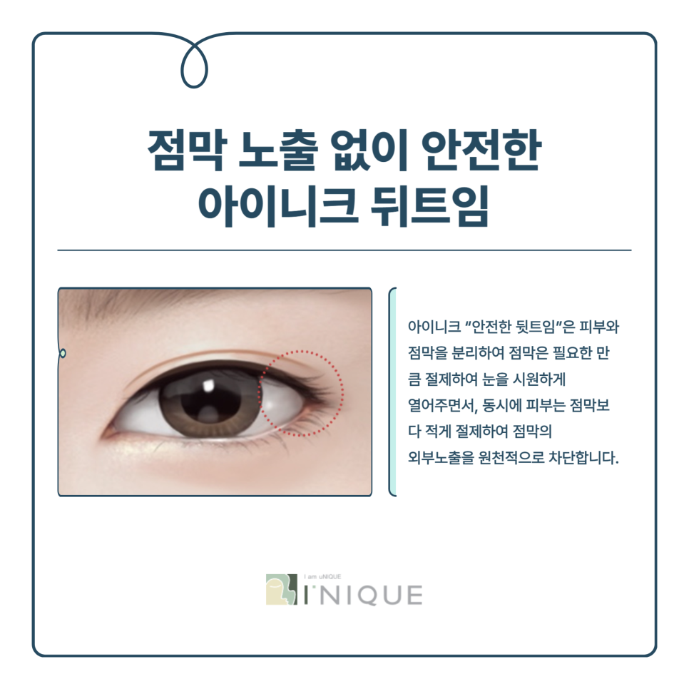 뒤트임잘하는곳 만의 특별함 관련 이미지 6